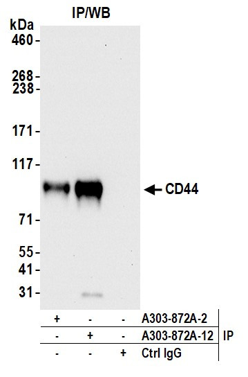 CD44 Antibody in Immunoprecipitation (IP)