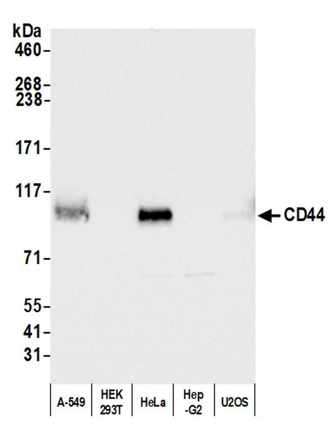 CD44 Antibody in Western Blot (WB)