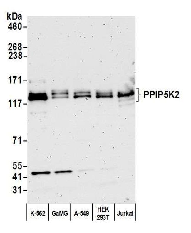 PPIP5K2 Antibody in Western Blot (WB)