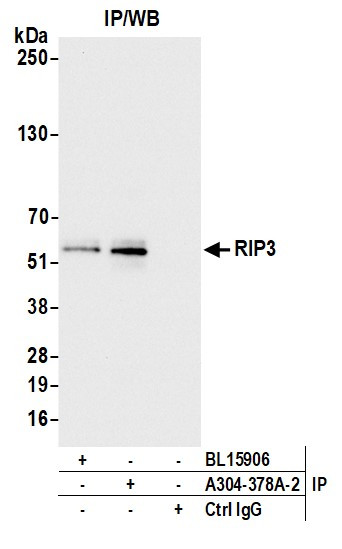 RIP3 Antibody in Immunoprecipitation (IP)