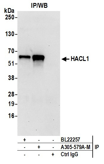 HACL1 Antibody in Immunoprecipitation (IP)