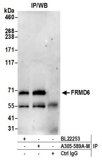 FRMD6 Antibody in Immunoprecipitation (IP)