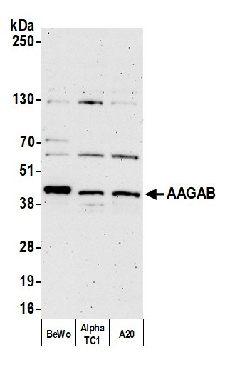 AAGAB Antibody in Western Blot (WB)