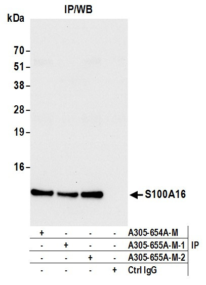 S100A16 Antibody in Immunoprecipitation (IP)
