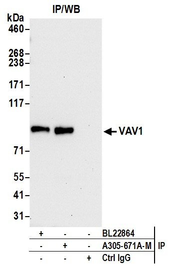 VAV1 Antibody in Immunoprecipitation (IP)