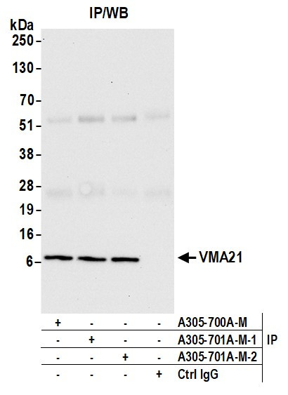 VMA21 Antibody in Immunoprecipitation (IP)