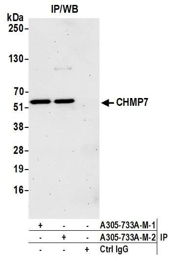 CHMP7 Antibody in Immunoprecipitation (IP)