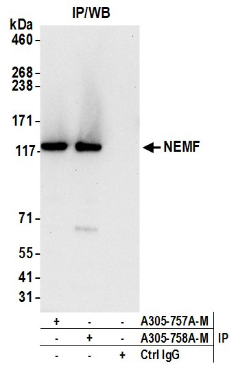 NEMF Antibody in Immunoprecipitation (IP)