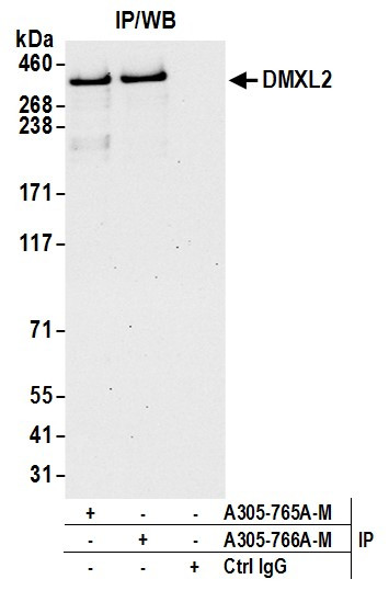 DMXL2 Antibody in Immunoprecipitation (IP)