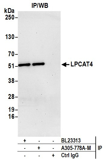 LPCAT4 Antibody in Immunoprecipitation (IP)