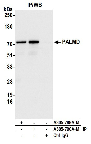 PALMD Antibody in Immunoprecipitation (IP)