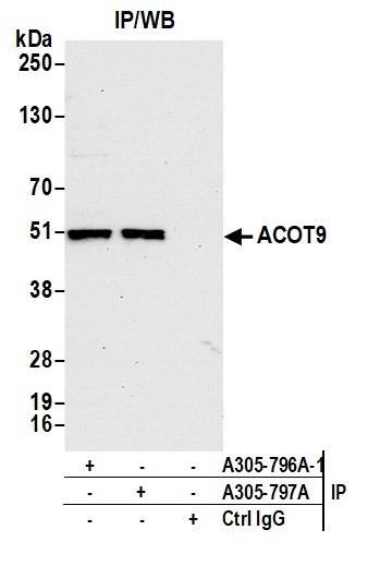 ACOT9 Antibody in Immunoprecipitation (IP)