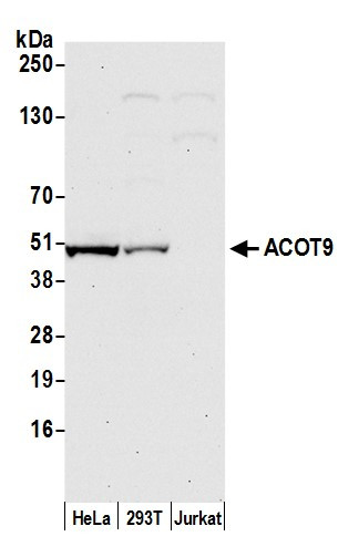 ACOT9 Antibody in Western Blot (WB)