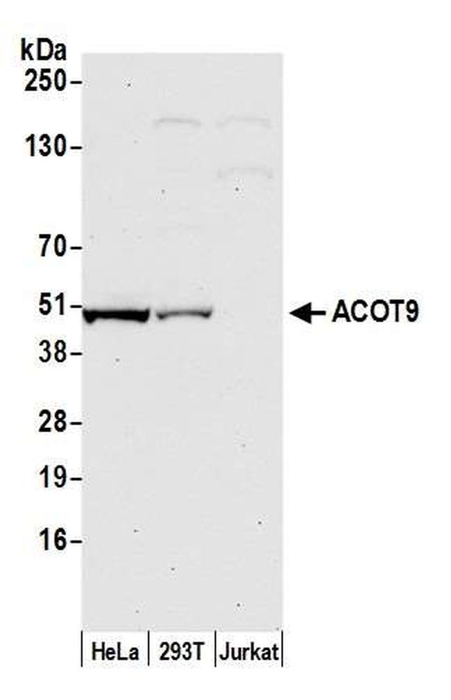 ACOT9 Antibody in Western Blot (WB)