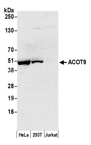 ACOT9 Antibody in Western Blot (WB)