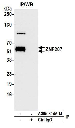 ZNF207 Antibody in Immunoprecipitation (IP)