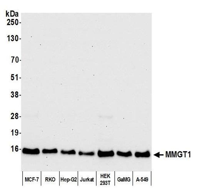 MMGT1 Antibody in Western Blot (WB)