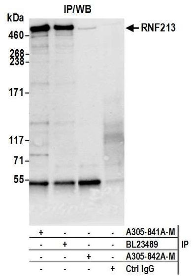 RNF213 Antibody in Immunoprecipitation (IP)