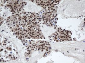 A4GNT Antibody in Immunohistochemistry (Paraffin) (IHC (P))