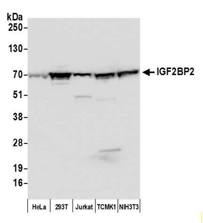 IGF2BP2 Antibody in Western Blot (WB)