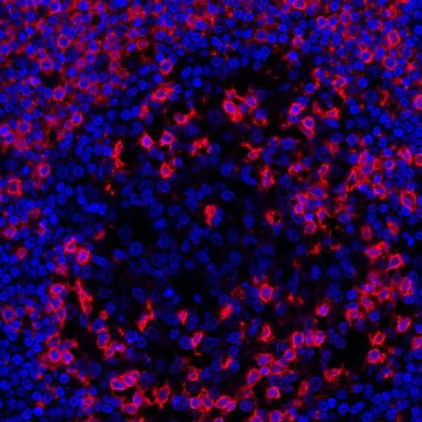 CD45RO Antibody in Immunohistochemistry (Paraffin) (IHC (P))