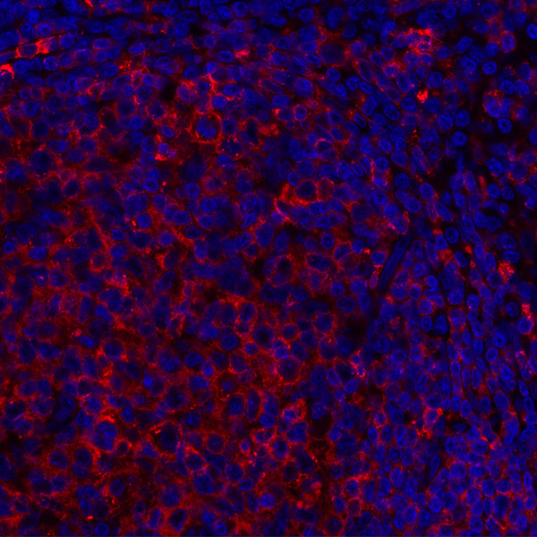 HLA-DR Antibody in Immunohistochemistry (Paraffin) (IHC (P))