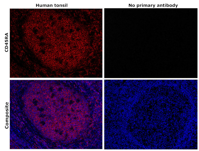 CD45RA Antibody in Immunohistochemistry (Paraffin) (IHC (P))