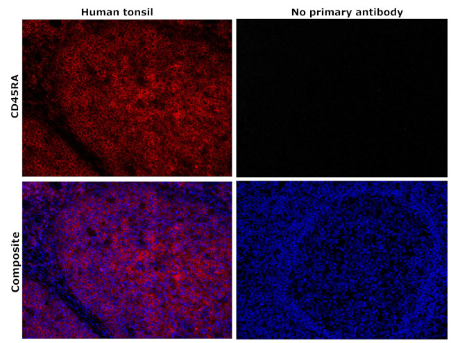 CD45RA Antibody in Immunohistochemistry (Paraffin) (IHC (P))