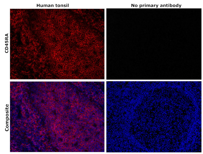 CD45RA Antibody in Immunohistochemistry (Paraffin) (IHC (P))