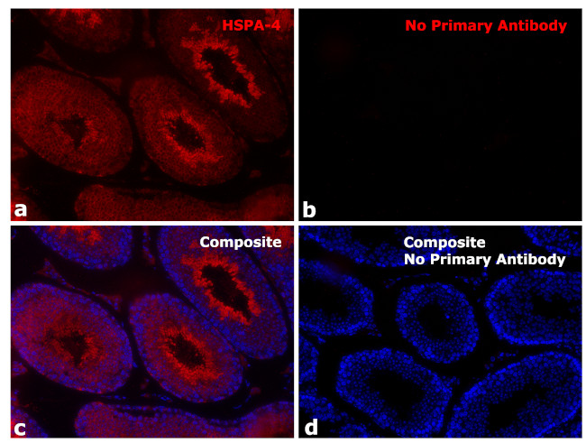 Human IgG Fab Secondary Antibody in Immunohistochemistry (Paraffin) (IHC (P))