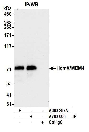 HdmX/MDM4 Antibody in Immunoprecipitation (IP)