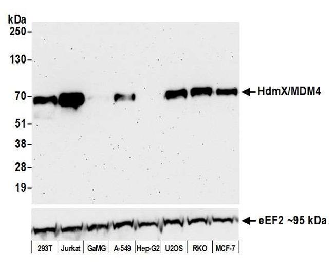 HdmX/MDM4 Antibody in Western Blot (WB)