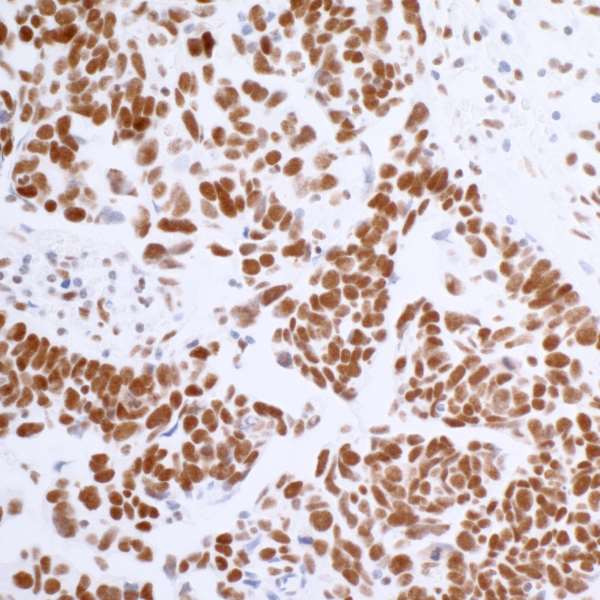 BRD4 Antibody in Immunohistochemistry (Paraffin) (IHC (P))