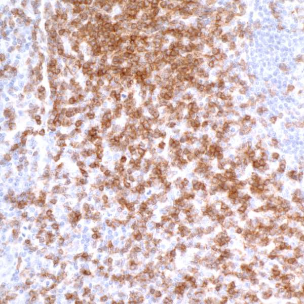 CD247/CD3Z Antibody in Immunohistochemistry (Paraffin) (IHC (P))