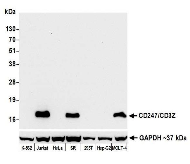 CD247/CD3Z Antibody in Western Blot (WB)