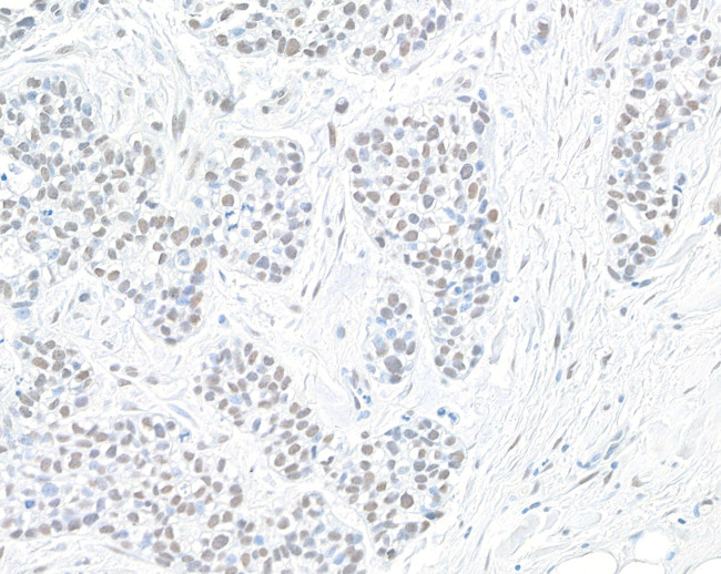 PBRM1 Antibody in Immunohistochemistry (Paraffin) (IHC (P))