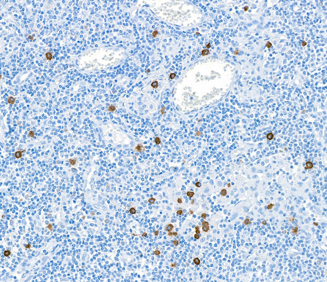 Granzyme B Antibody in Immunohistochemistry (Paraffin) (IHC (P))