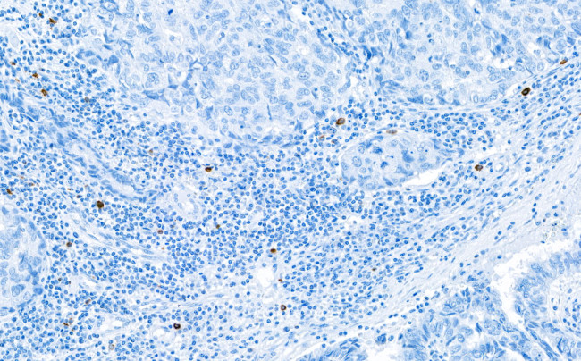 Granzyme B Antibody in Immunohistochemistry (Paraffin) (IHC (P))