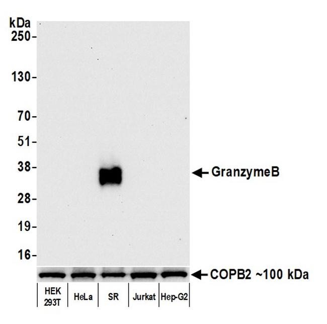 Granzyme B Antibody in Western Blot (WB)