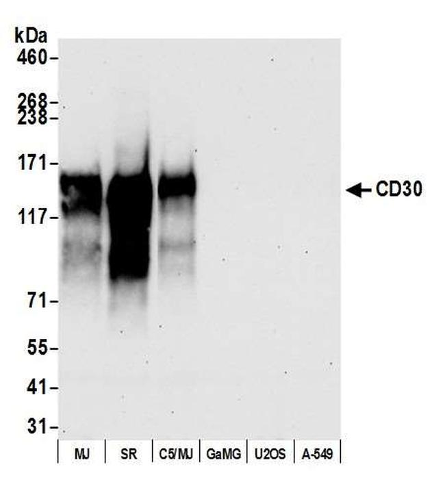 CD30 Antibody in Western Blot (WB)