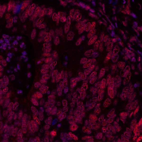 BRD3 Antibody in Immunohistochemistry (Paraffin) (IHC (P))