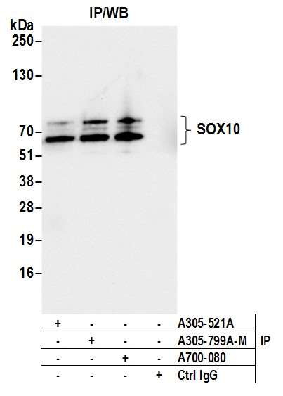SOX10 Antibody in Immunoprecipitation (IP)