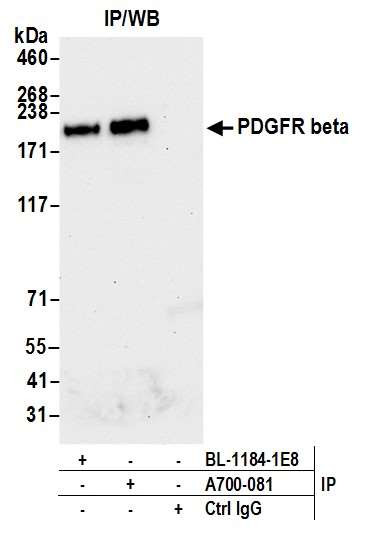 PDGFR beta Antibody in Immunoprecipitation (IP)