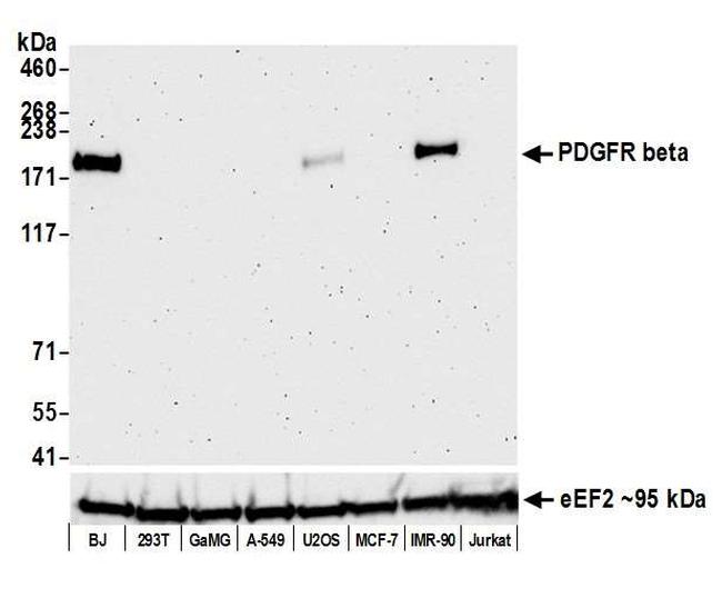 PDGFR beta Antibody in Western Blot (WB)