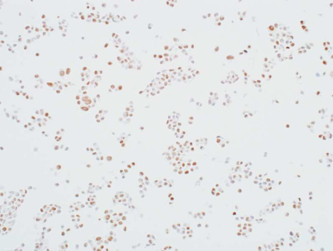 MED12 Antibody in Immunocytochemistry (ICC/IF)