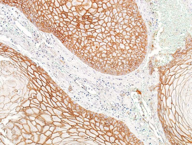 E-Cadherin Antibody in Immunohistochemistry (Paraffin) (IHC (P))