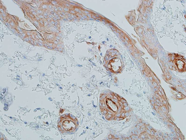 E-Cadherin Antibody in Immunohistochemistry (Paraffin) (IHC (P))