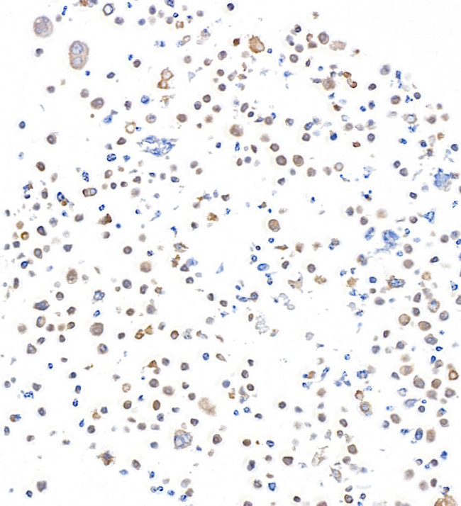 SMAD4 Antibody in Immunocytochemistry (ICC/IF)