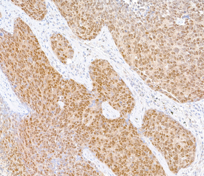 SMAD4 Antibody in Immunohistochemistry (Paraffin) (IHC (P))