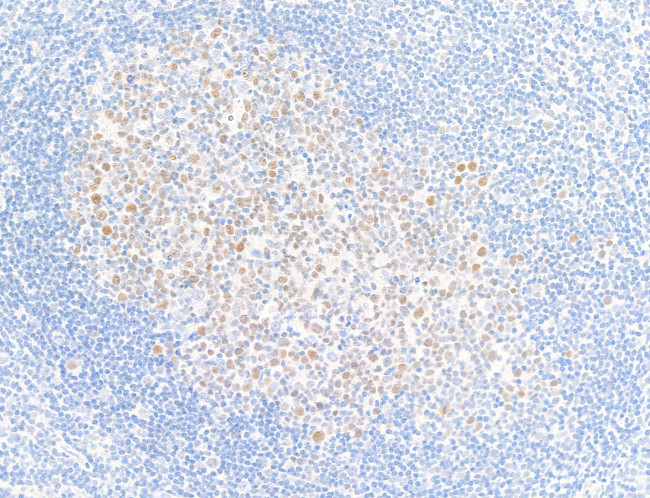 Bcl6 Antibody in Immunohistochemistry (Paraffin) (IHC (P))